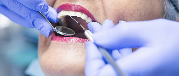 Best Emergency Dental Care for Broken or Chipped Teeth in Trooper, PA